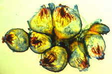 11-15 Ascobolus2.jpg (6937 bytes)