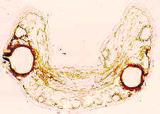 11-70 Fusicoccum needle ts.jpg (6855 bytes)