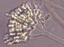 11-7 Syncephalis2.jpg (5339 bytes)