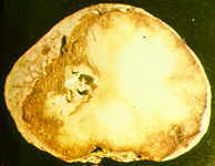 20-6 blighted potato.jpg (5136 bytes)