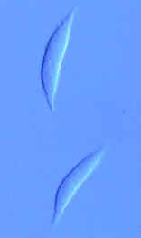 4 Hypomyces ascospores.jpg (4683 bytes)