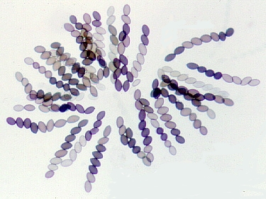 Ascospore colour.jpg (97791 bytes)