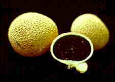 sclerod1.jpg (3620 bytes)